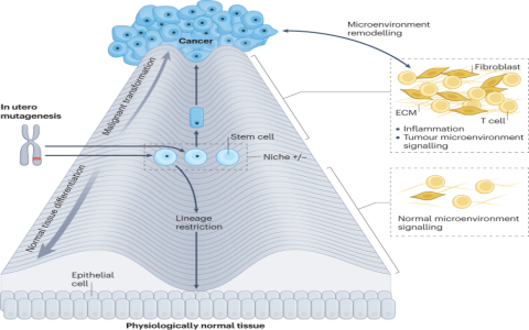 Understanding Cancer in the Second House: Key Insights
